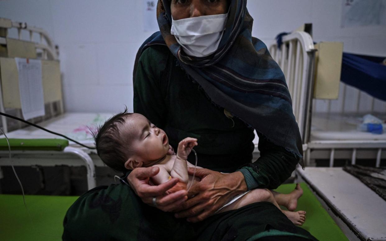 A baby receives treatment for malnutrition - AFP/Hector Retamal