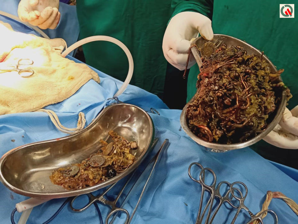 A doctor holds the 1.6 kg mass in a metal hospital box.