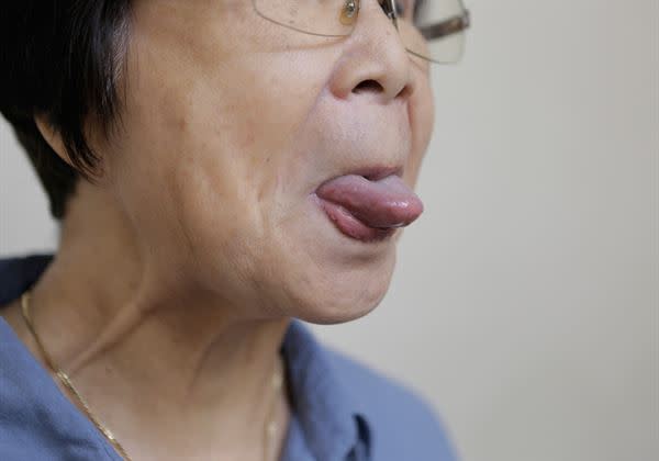 舌頭運動：舌頭前伸與後捲。(圖片提供／陽明大學牙醫學系)
