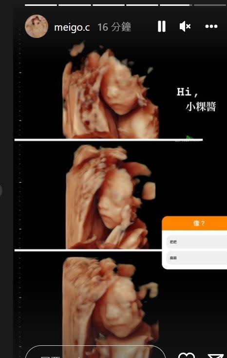 粿粿曬出超音波照片。（圖／翻攝自粿粿IG）