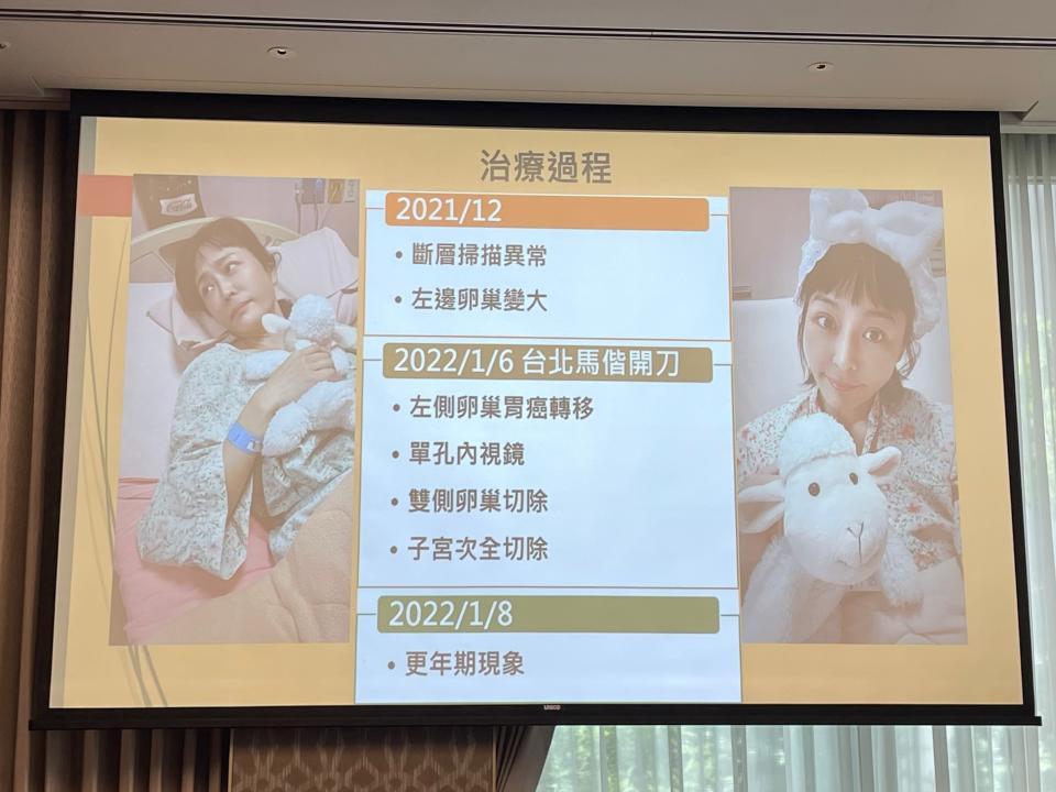 唐玲在2019年被診斷罹患胃癌四期（圖／記者簡子喬攝影）