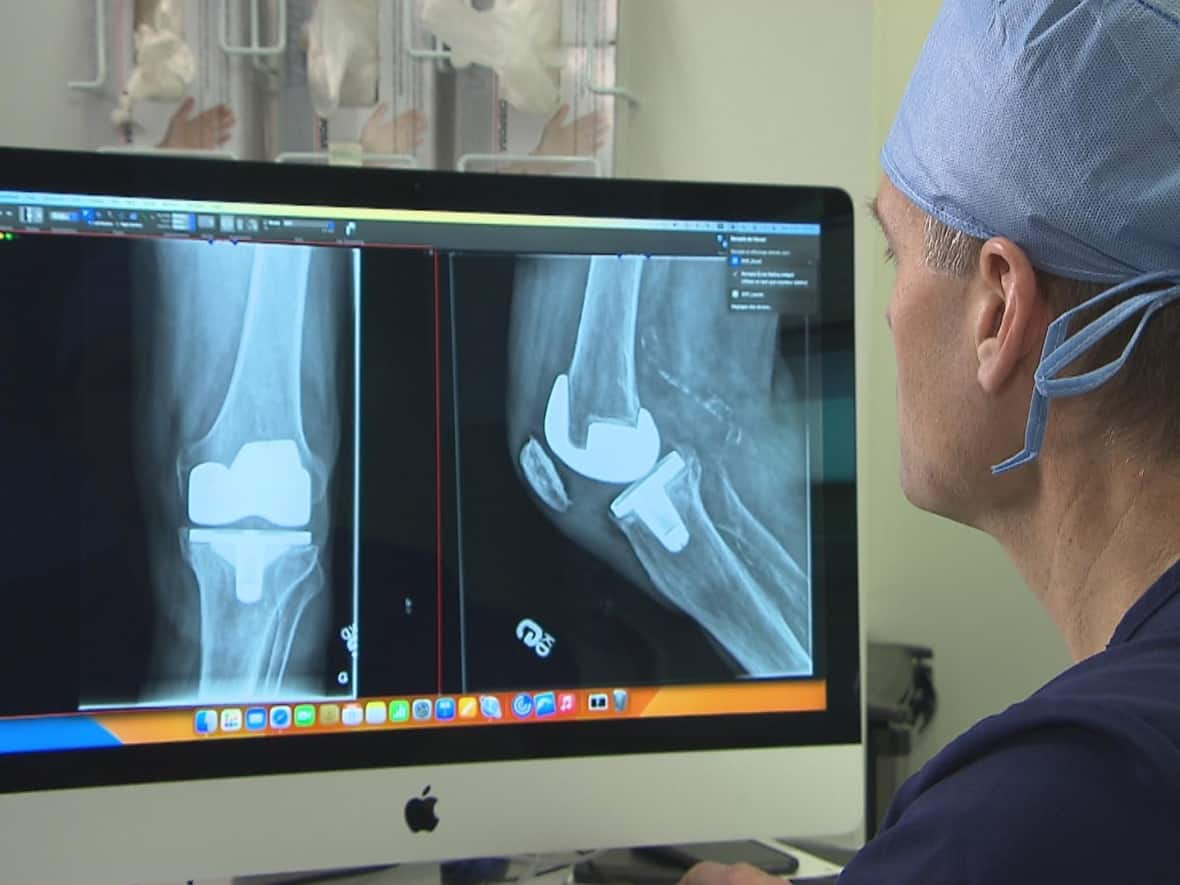A doctor studies images of a patient's knee replacement surgery at a private medical facility in Laval, Que. The orthopedic surgeons behind a private group performing similar procedures at the Riverside campus of The Ottawa Hospital on weekends is defending the partnership. (Louis-Marie Philidor/CBC - image credit)