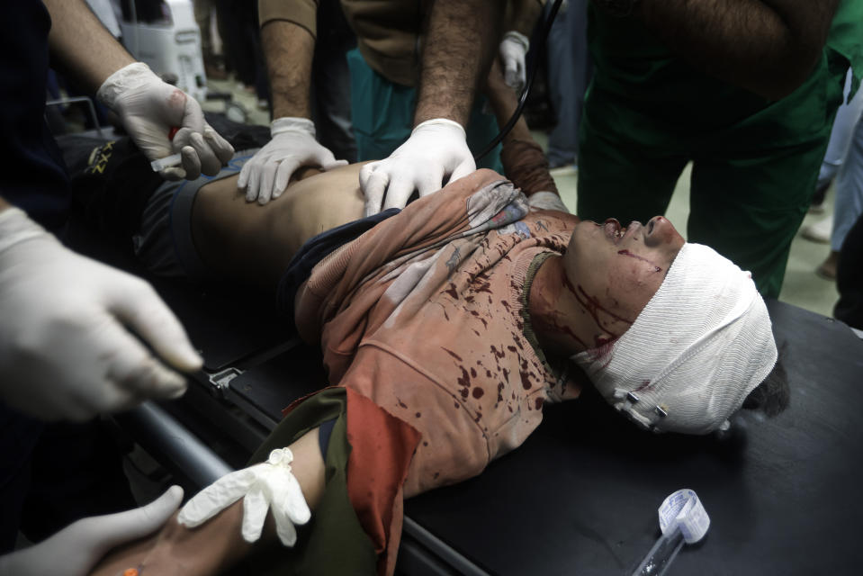 A Palestinian wounded in the Israeli bombardment of the Gaza Strip receives treatment at the Nasser hospital in Khan Younis, Southern Gaza Strip, Tuesday, Jan. 2, 2024. (AP Photo/Mohammed Dahman)