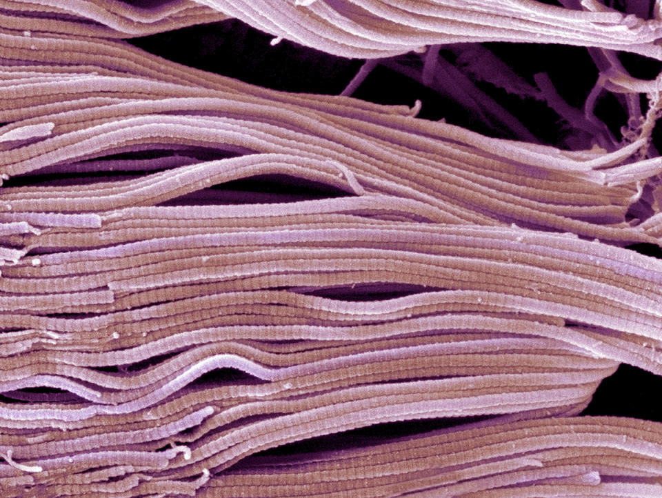 Scanning electron micrograph (SEM) of collagen bundles from the delicate connective tissue endoneurium which wraps around and between individual nerve fibres (axons). The characteristic banding of collagen can be seen in this image. Magnification: x3000 when printed at 10 centimetres wide.