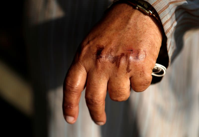 A man's hand is seen after washing off the home quarantine stamp on a street in Dharavi, one of Asia's largest slums, Mumbai,