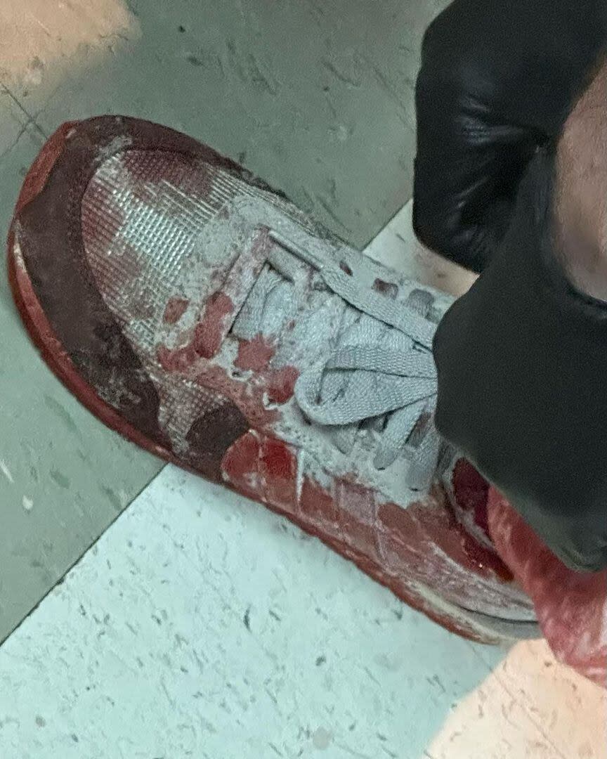 El zapato cubierto de sangre que alertó a los fans