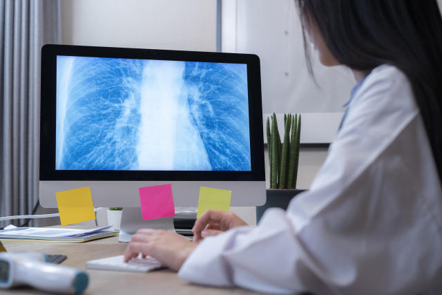 Doctor looking at a chest x-ray on a computer to diagnose Tuberculosis
