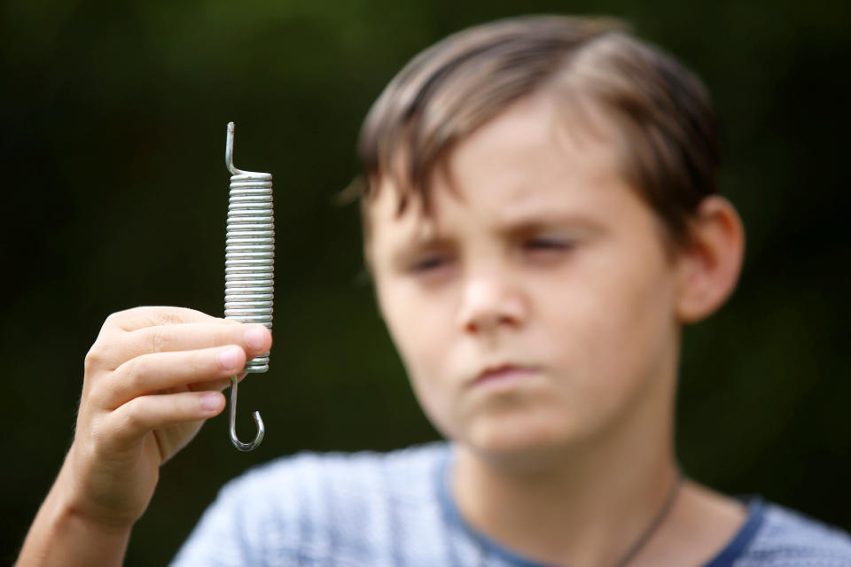 A six-inch spring was lodged in Jamie's back (Picture: SWNS)