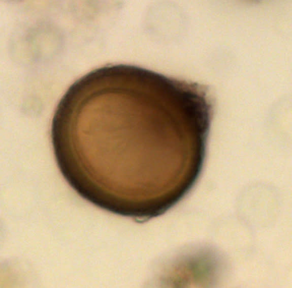 parasite eggs in stool