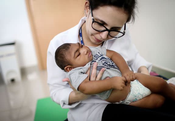 A doctor performs physical therapy on an infant born with microcephaly, or an unusually small skull.