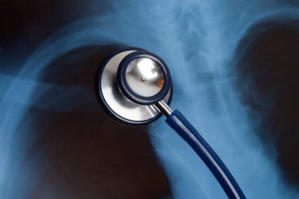 stethoscope and x ray photo