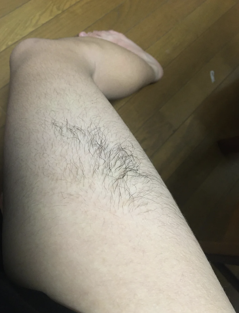 Close-up of a person's leg showing hair growth