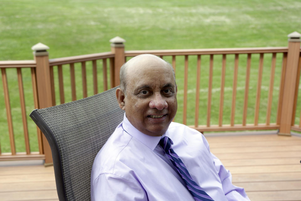 CORRECTS LAST NAME TO SHELAT, NOT SHEBAT, IN SECOND REFERENCE - Kiran Shelat, a 65-year-old retired civil engineer, poses for a portrait in his home, Monday Aug. 6, 2018, in Yardley, Pa. Shelat had spent two years on a kidney transplant waiting list before signing up for a bold experiment with 19 others in which they received organs infected with hepatitis C. A study finds U.S. patients who accepted kidneys infected with hepatitis C were later cured. Results were published Monday in the journal Annals of Internal Medicine. (AP Photo/Jacqueline Larma)