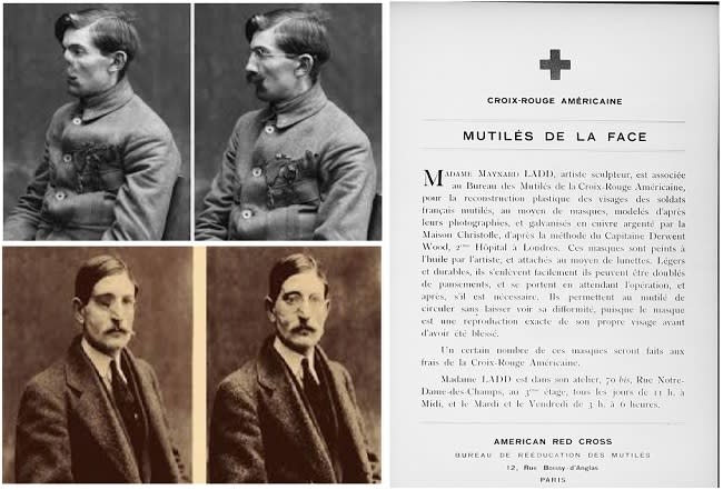 Dos de los muchos soldados desfigurados atendidos por Anna Coleman y a la derecha la carta que hizo llegar a hospitales y médicos franceses ofreciendo sus servicios, donde se presentaba como la ‘señora Maynard Ladd’ (imágenes vía Library of Congress)