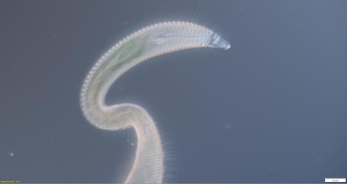 Imagen microscópica del nematodo epsilonema.