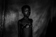 <p>Banned beauty: Suzanne, 11 years old, East Cameroon, Nov. 12, 2016. Two months before that image was taken, she experienced breast ironing until her breasts were totally gone.<br>Breast ironing is a traditional practice in Cameroon that involves massaging or pressing the breasts of pubescent girls in order to suppress or reverse breast development. The practice is carried out in the belief that it will delay maturity and help prevent rapes or sexual advances. Breast ironing is usually done by the girl’s mother or an older relative. Techniques differ from region to region. Some people bind the breasts with a belt, others heat a grinding stone, spatula or pestle and use it to press or massage the breasts.<br>Although largely a Cameroonian practice, breast ironing does occur in some other countries across West and Central Africa. Local NGOs estimate that around 25 percent of women in the Cameroon have undergone some form of breast flattening; in some areas that rises to over 50 percent. Mothers explain that the painful procedure is an act of love, to make sure their daughters don’t get pregnant and miss out on school or jobs. There is little medical research on the psychological and physical consequences of breast flattening, but according to the United Nations Population Fund, the practice exposes girls to numerous health problems deriving from tissue damage and infection. (Photo: Heba Khamis) </p>