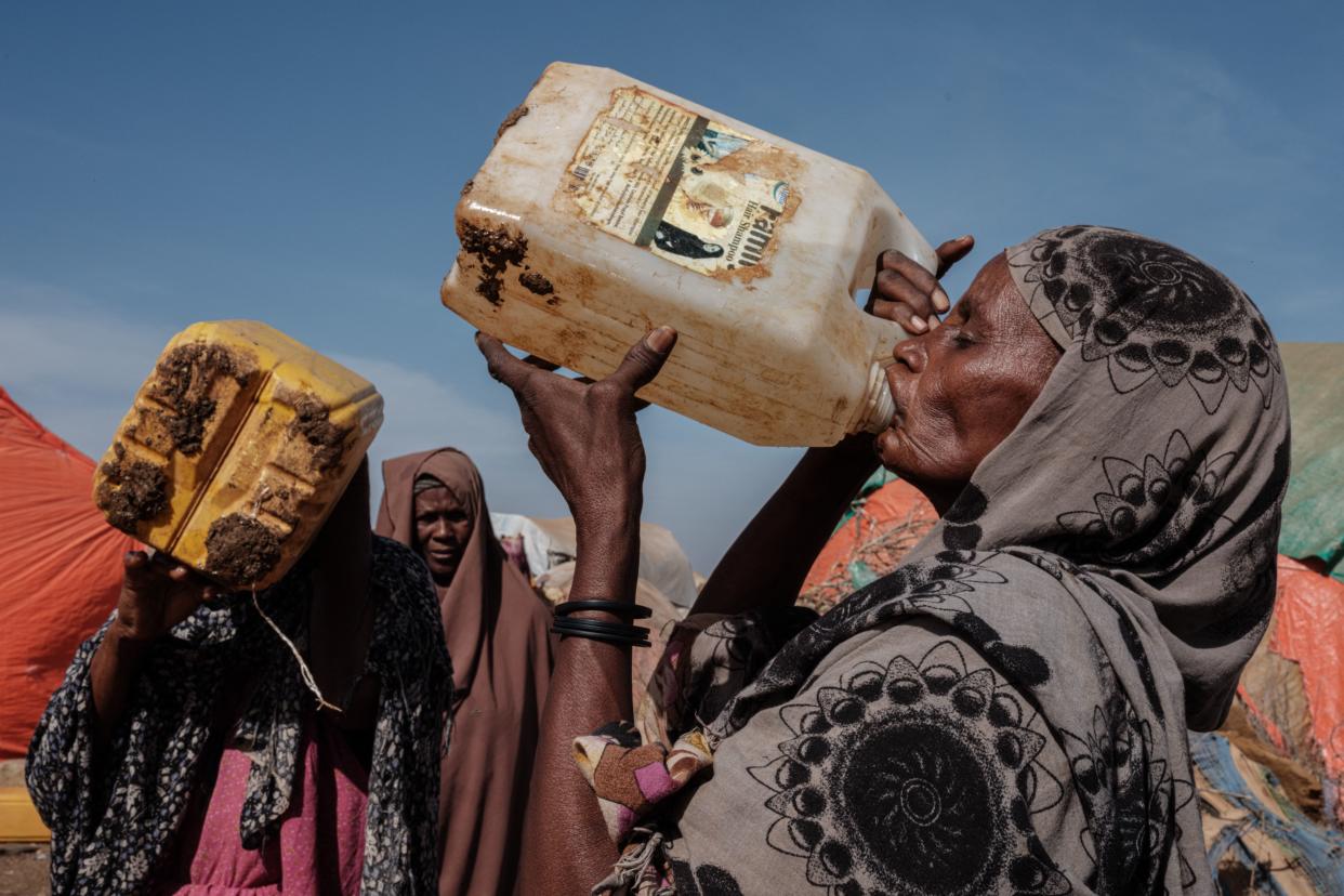 TOPSHOT-SOMALIA-DISPLACED-DROUGHT-FAMINE