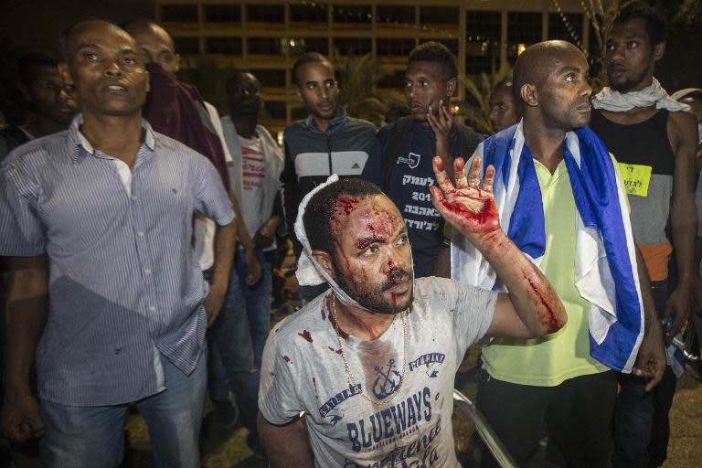 A Israeli man from the Ethiopian community bleeds after clashes with Israeli security forces in the coastal city of Tel Aviv on May 3, 2015