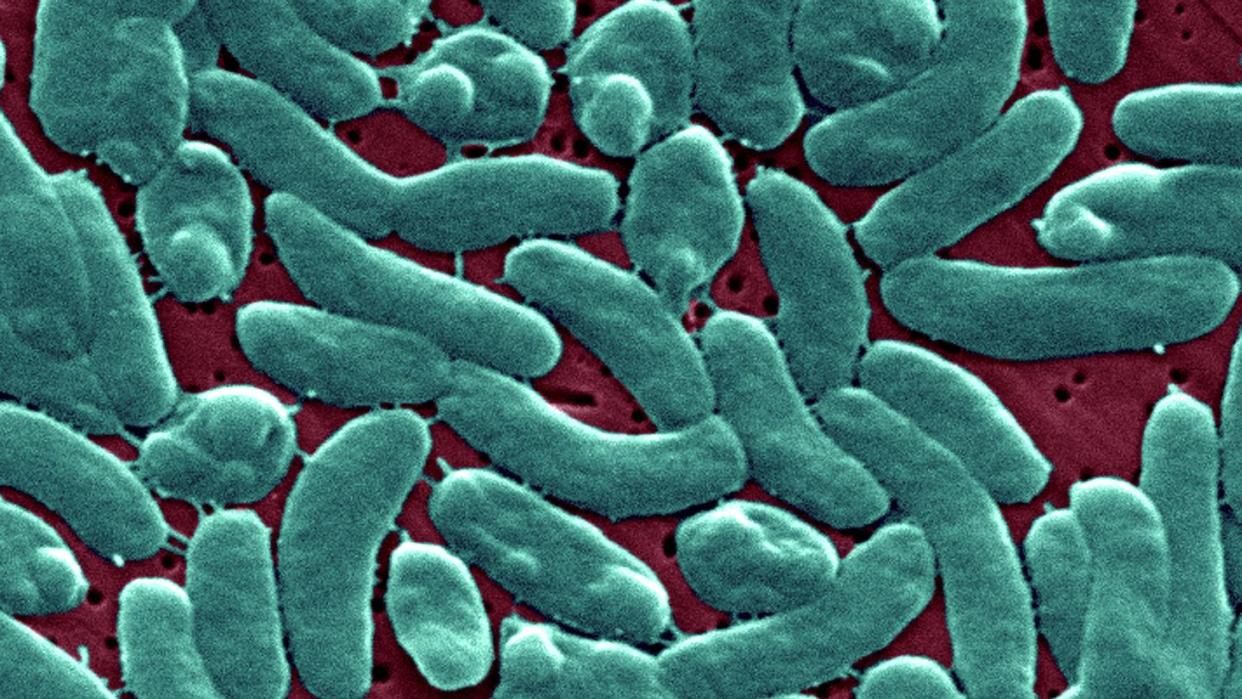 flesh eating bacteria cdc warning vibrio vulnificus, explained