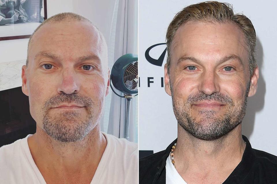 <p>Brian Austin Green Instagram; Steve Granitz/FilmMagic</p> Brian Austin Green has debut his newly shaved head on Instagram