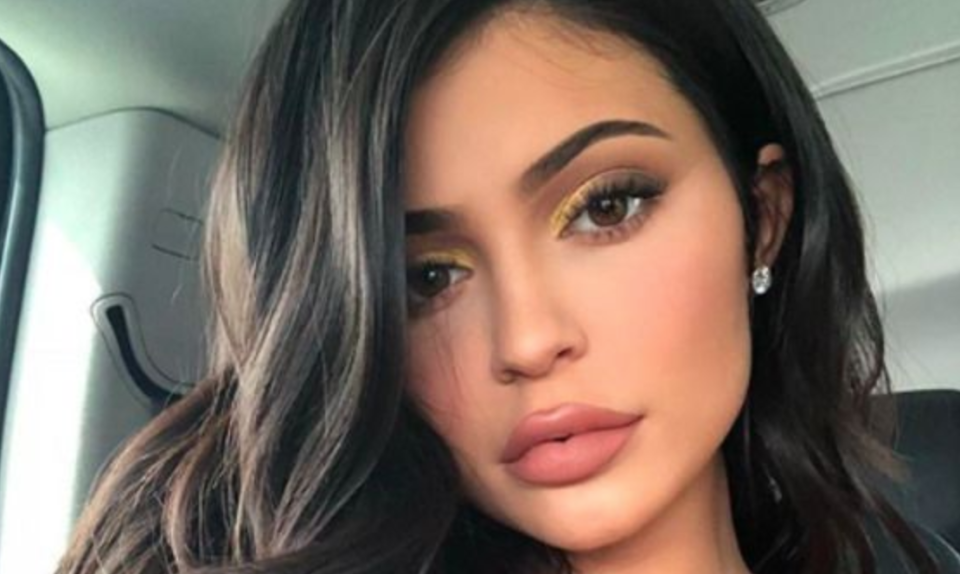 Jenner posteó una foto en la que varios de sus seguidores notaron un cambio en su rostro. Foto: <a href="https://www.instagram.com/p/Bi74YFQl_qN/?taken-by=kyliejenner" rel="nofollow noopener" target="_blank" data-ylk="slk:Instagram.com/kyliejenner;elm:context_link;itc:0;sec:content-canvas" class="link ">Instagram.com/kyliejenner</a>