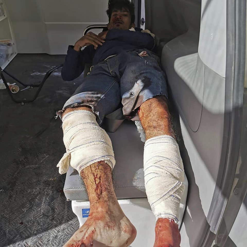 A man injured in an airstrike that hit a biscuit factory waits in an ambulance in the capital, Tripoli, Libya, Monday, Nov. 18, 2019. Tripoli has been the scene of fighting since April between the self-styled Libyan National Army and an array of militias loosely allied with the U.N.-supported but weak government which holds the capital. (Center for Field Medicine and Support via AP)