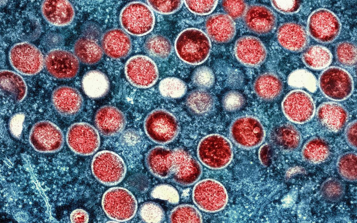 A false-colour image of monkeypox particles (red) found within an infected cell