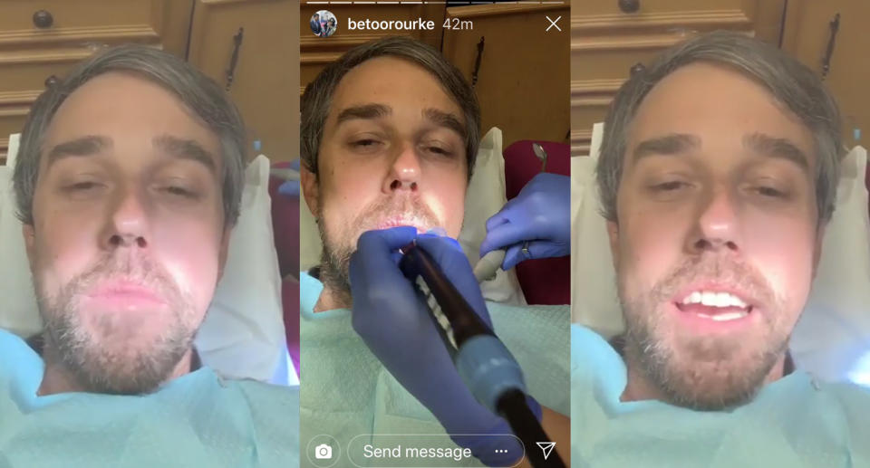 Beto O’Rourke posted a video of him getting a dental procedure on Instagram. (Screengrabs: Yahoo News via Instagram)