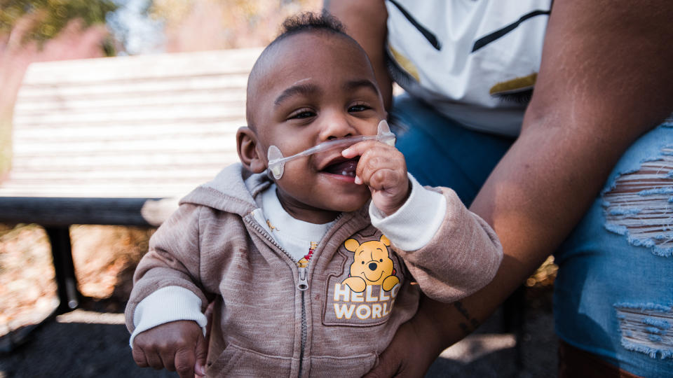 Curtis Means was born at 21 weeks, making him the world's most premature baby to survive. (Photo: Andrea Mabry)