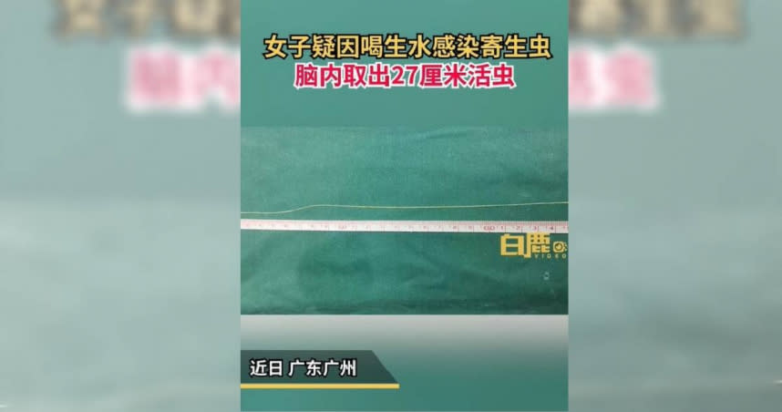 大陸有位女士感染寄生蟲，醫生從她顱內取出27公分長裂頭蚴，疑是她飲用生水習慣所致。（圖／翻攝「白鹿視頻」微博）