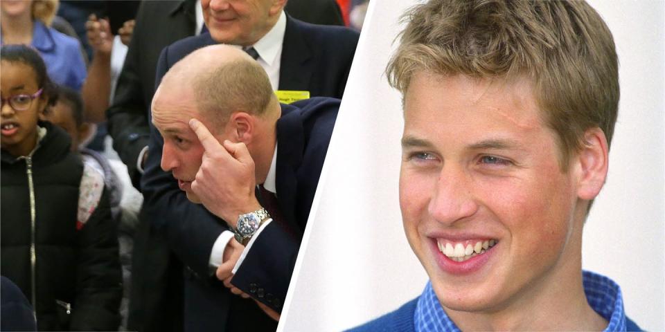 <p>Kate Middleton isn't the only royal to have a scar on her head; her husband, Prince William also has one - and he legit calls it his "Harry Potter scar". The Prince was accidentally<a href="https://www.cosmopolitan.com/uk/reports/a22847704/prince-william-scar/" rel="nofollow noopener" target="_blank" data-ylk="slk:hit with a golf club;elm:context_link;itc:0;sec:content-canvas" class="link "> hit with a golf club</a> when he was 13, leading to the permanent mark on the left side of his forehead. </p><p>"I call it [my Harry Potter scar] because it glows sometimes and some people notice it — other times they don't notice it at all," he said in a 2009 <a href="http://www.dailymail.co.uk/news/article-1163000/Who-gave-Prince-William-Harry-Potter-scar-Royal-reveals-friend-hit-golf-club.html" rel="nofollow noopener" target="_blank" data-ylk="slk:interview;elm:context_link;itc:0;sec:content-canvas" class="link ">interview</a>.</p>