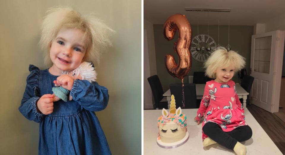 Layla has been diagnosed with uncombable hair syndrome (UHS) - a condition characterised by dry, frizzy hair which defies attempts to tame it. (Charlotte Davis/SWNS)