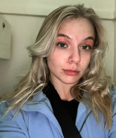 <p>Abbie O'Connor</p> Abbie O'Connor 30 minutes after her eyebrow wax