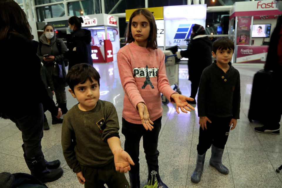 Children of the Iraqi migrants show hands with wounds and infections to the members of the media as they arrive to the airport in Irbil, Iraq, early Friday, Nov. 26, 2021. A second group of Iraqis have returned home in repatriation flights after a failed bid to enter Europe. Over 170 people returned on a flight that landed in Irbil airport in the northern Kurdish-run region Friday morning. (AP Photo/Hussein Ibrahim)