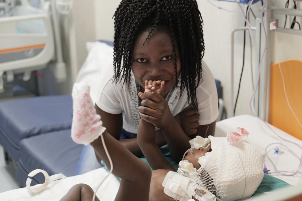 Mom, Ermine, feels grateful that her daughters have a new chance at life following their separation surgery.  (Courtesy Bambino Gesu Pediatric Hospital)