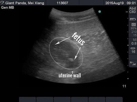 An ultrasound image of the National Zoo's giant panda Mei Xiang is pictured in this handout photograph taken and released on August 19, 2015. REUTERS/Smithsonian's National Zoo/Handout via Reuters