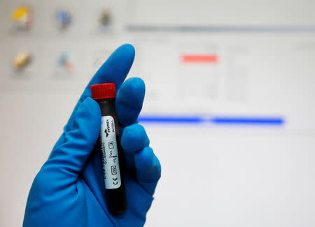 A technician holds a test tube with a blood sample at the Russian anti-doping laboratory in Moscow, Russia, May 24, 2016. REUTERS/Sergei Karpukhin/File Photo