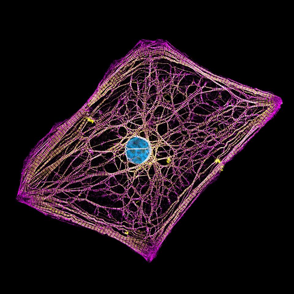 Human cardiomyocytes (heart cells) derived from induced pluripotent stem cells