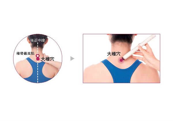 大椎穴位在項背部脊柱區，第7頸椎棘突下凹陷中，後正中線上。（圖片／大是文化提供）
