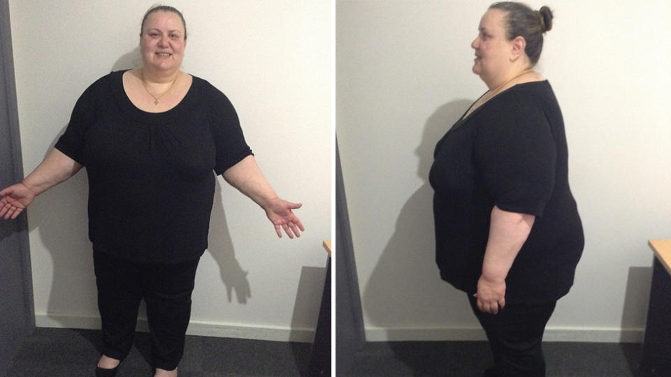 Anna tipped the scales at 206kg before starting her weight loss journey. Photo: Supplied/Anna Kambranis/Vision