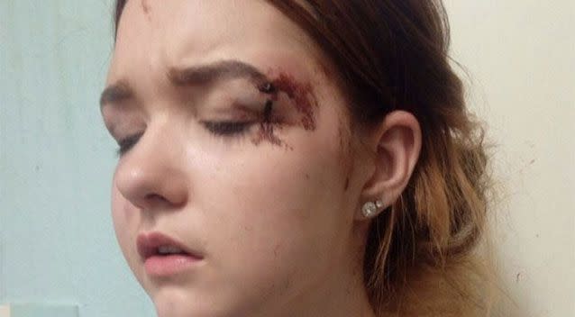 Michelle sustained a cut to her forehead, a cracked skull and grazes all over her body. Photo: Mercury