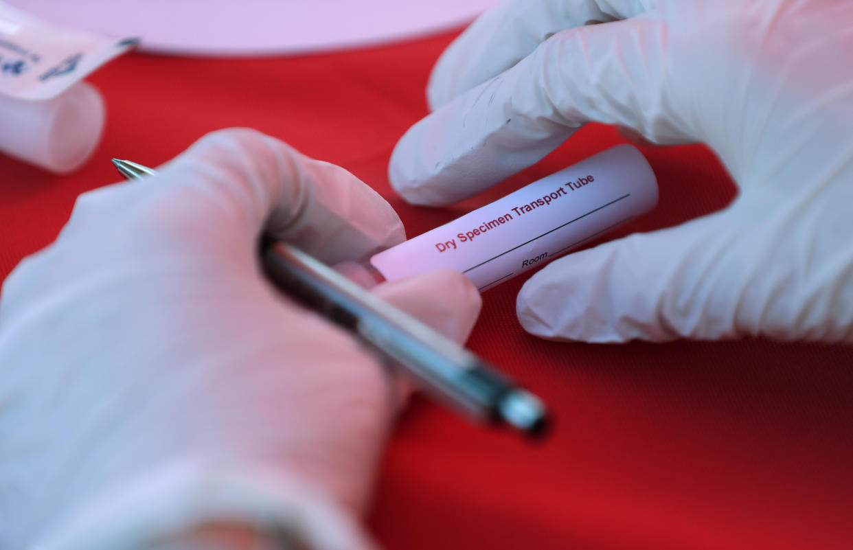 Hong Kong has reported the first probable case of COVID-19 reinfection, but experts say it's no reason to panic. Here, a worker prepares a collection tube in California. (AP Photo/Wilfredo Lee)