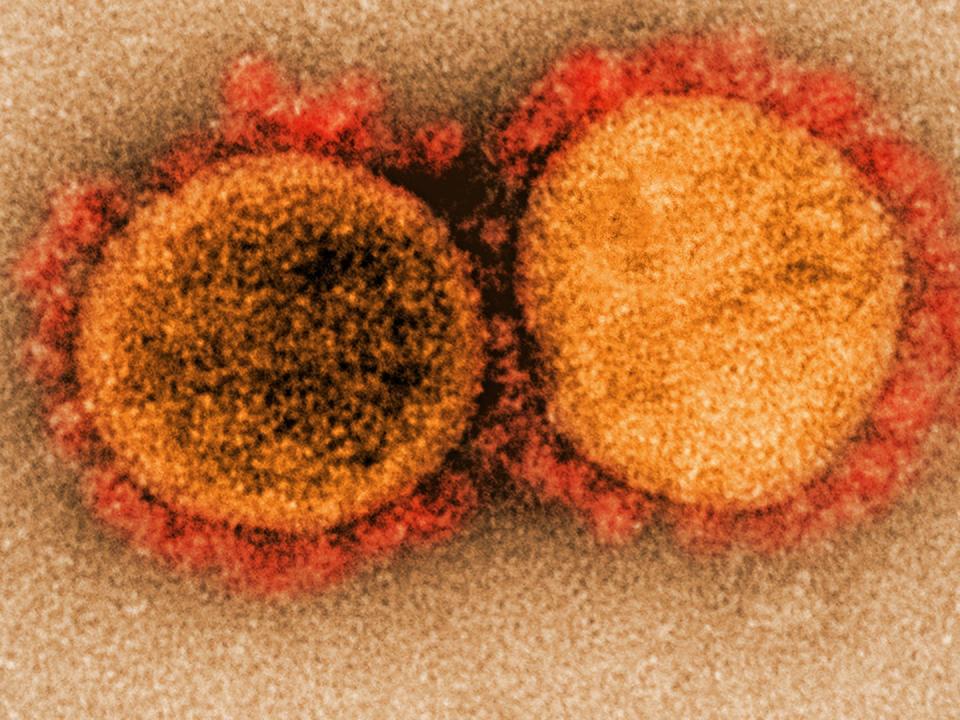 An illustration of two orange and red cells with to represent SARS-CoV-2 against a light orange background.