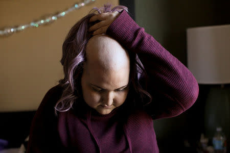 Puerto Rican Keyshla Betancourt, 22, who suffers from brain cancer, takes off her wig after her first radiotherapy treatment, at a hotel, in Orlando, Florida, U.S., December 11, 2017. REUTERS/Alvin Baez