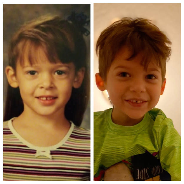 <div><p>"Here's my Kindergarten picture and my son at the same age. <b>He’s definitely mine — down to the gap</b>!"</p><p>—<a href="https://www.buzzfeed.com/machouse150" rel="nofollow noopener" target="_blank" data-ylk="slk:machouse150;elm:context_link;itc:0;sec:content-canvas" class="link ">machouse150</a></p></div><span><a href="https://www.buzzfeed.com/machouse150" rel="nofollow noopener" target="_blank" data-ylk="slk:buzzfeed.com;elm:context_link;itc:0;sec:content-canvas" class="link ">buzzfeed.com</a></span>