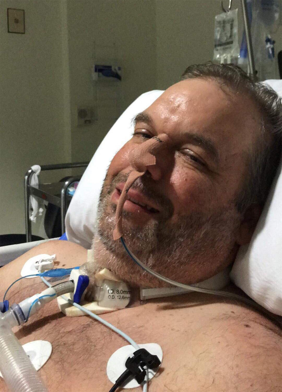 Mr Coard remains in a Perth hospital, as his family raise money to fly him home to Brisbane