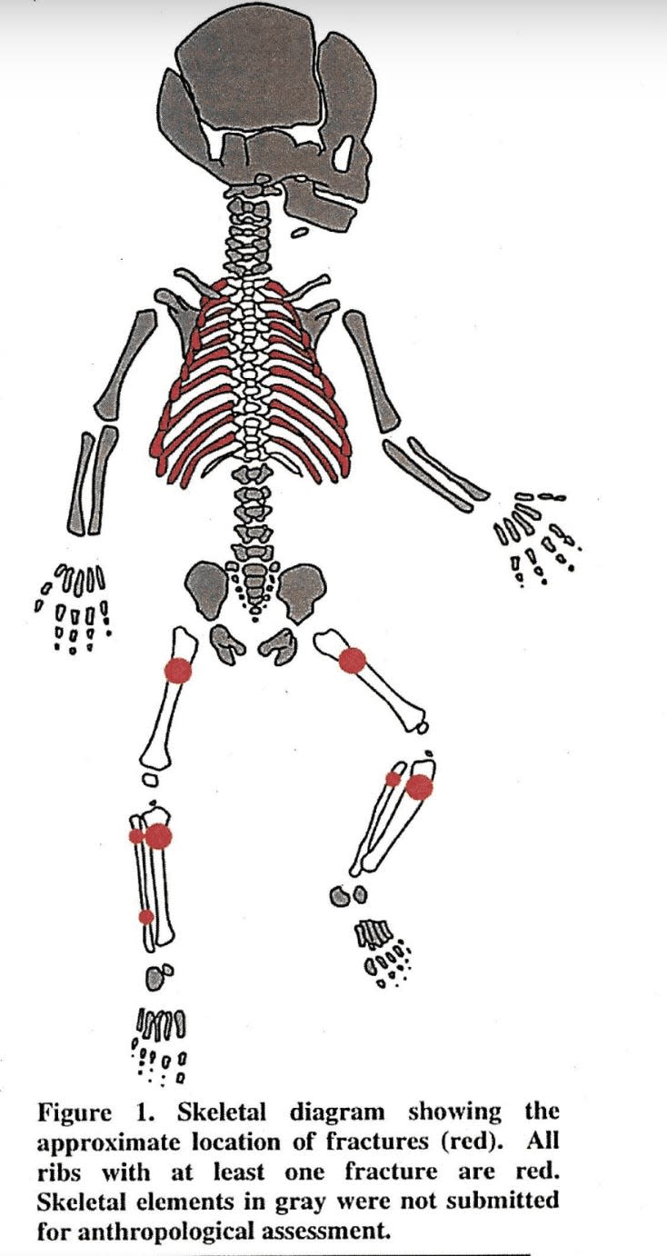 A diagram from Nikolaii's autopsy.