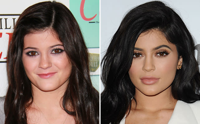 Kylie Jenner antes y ahora/Getyy Images