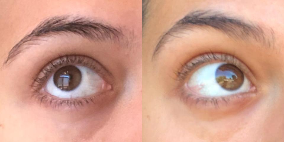 Results of the Radiance Eye Cream after two weeks of use: Week one (left photo), week two (right photo). 