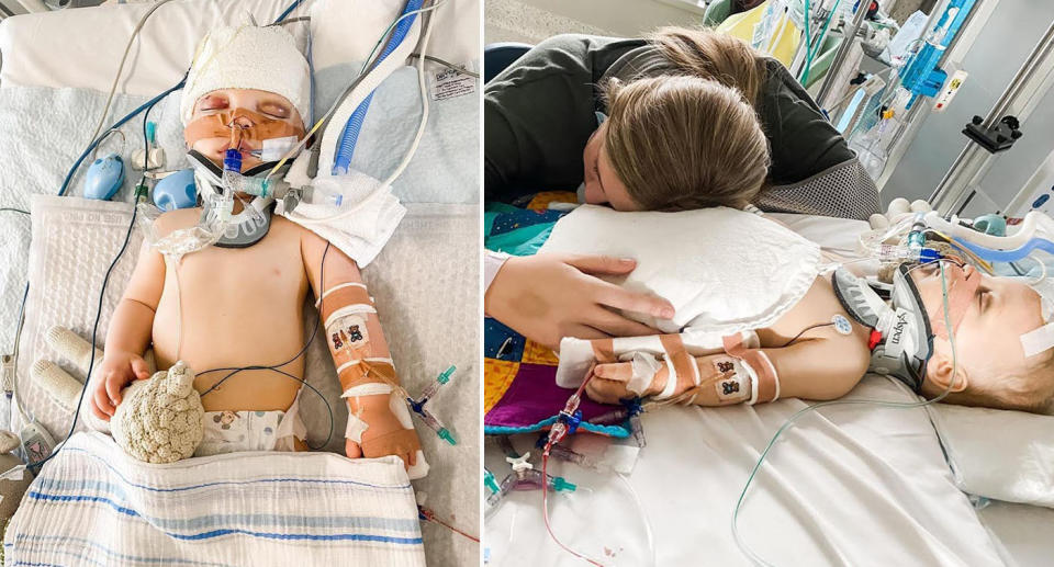 baby in hospital with bandages and wires (left) mum comforting son in hospital with bandages and wires  (right)